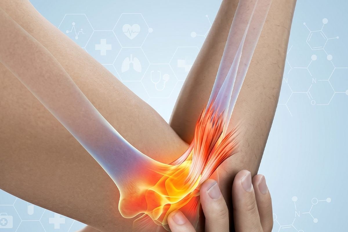 제주 팔꿈치통증·테니스엘보·골프엘보 — 팔꿈치 통증 부위 일러스트